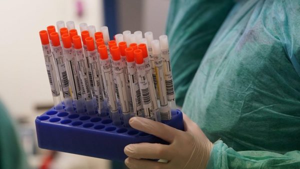 В Кировоградской области новый антирекорд: 149 человек заболели коронавирусом