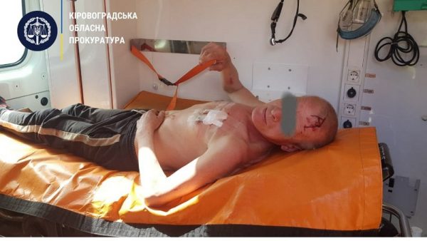 Сына, который подрезал своего отца в одном из сел Кировоградской области, взяли под стражу